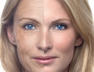 Natural Wrinkle Remedies